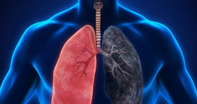 ICTQual Level 3 Award in Global Health Initiative: Chronic Obstructive Pulmonary Disease Awareness