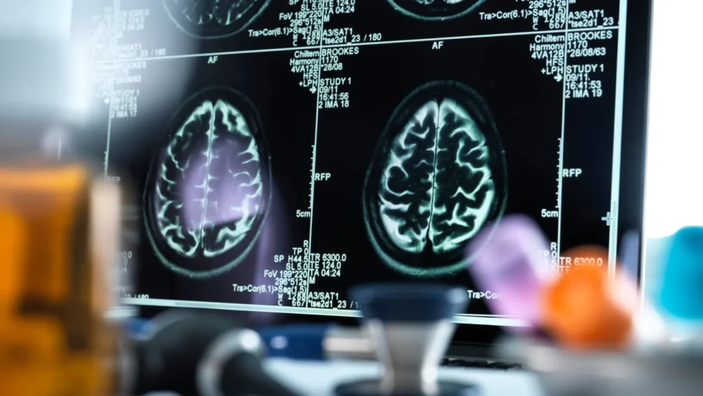 ICTQual AB Level 3 Diploma in Nephrology (Dip N)