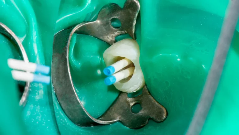 ICTQual AB Level 6 Diploma in Endodontics (Dip Endodontics)