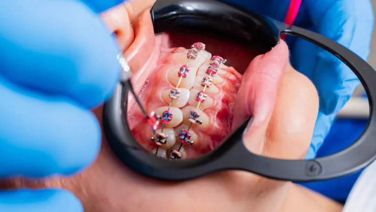 ICTQual AB Level 7 Postgraduate Diploma in Orthodontics (PgD Orthodontics)