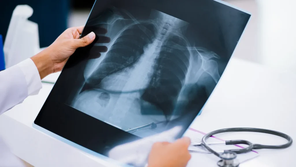 ICTQual AB Level 7 Postgraduate Diploma in Radiology (PgDRD)