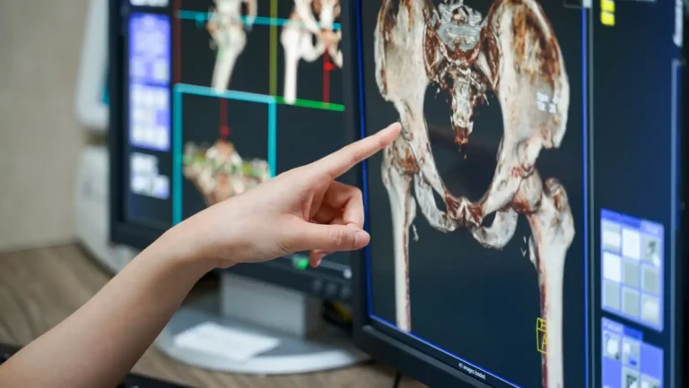 ICTQual AB Level 4 International Diploma in Radiology and Imaging Technology